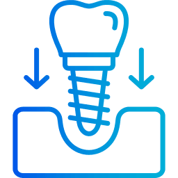 Dental implant treatment for missing tooth replacement
